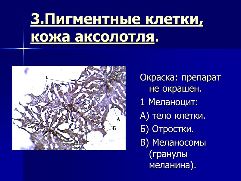 3.Пигментные клетки, кожа аксолотля.  Окраска: препарат не окрашен. 1 Меланоцит:  А) тело